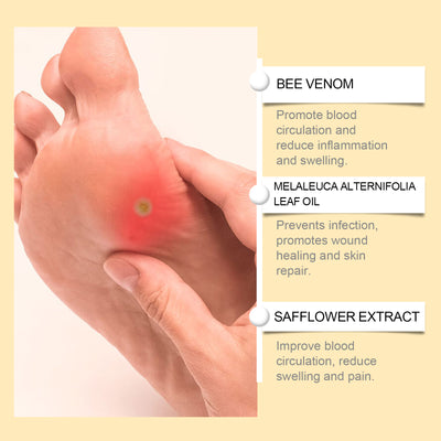 Bee Venom Foot Care Spray, Relieves Swelling, Peeling And Cracking Feet, Cleans And Moisturizes Beriberi Spray