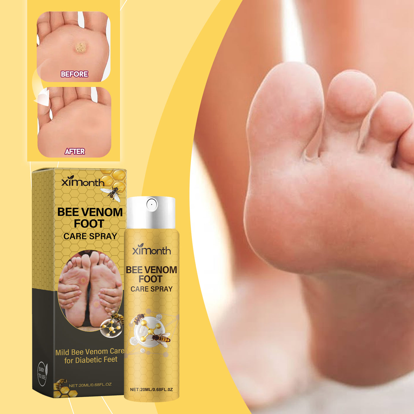 Bee Venom Foot Care Spray, Relieves Swelling, Peeling And Cracking Feet, Cleans And Moisturizes Beriberi Spray